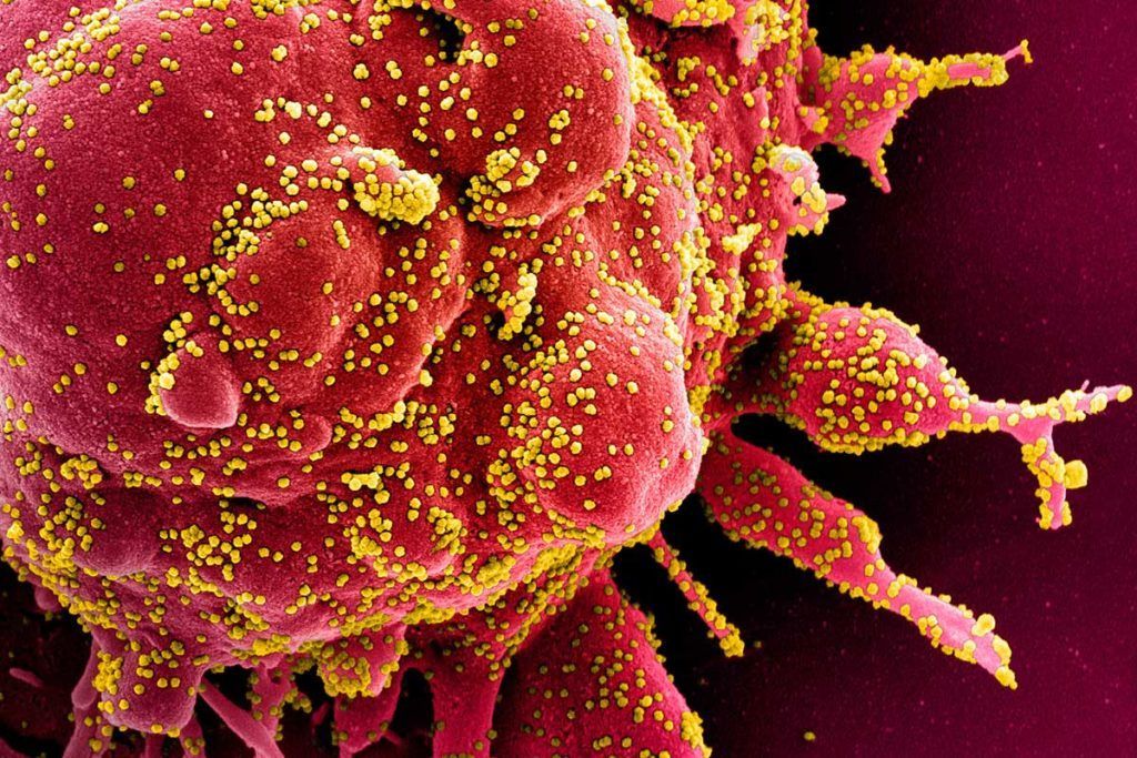 ‘Robo4’, la molécula que reduce la mortalidad en infecciones graves