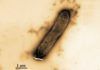 Nanopartículas de plata contra bacterias resistentes a antibióticos Nanopartículas de plata contra bacterias resistentes a antibióticos