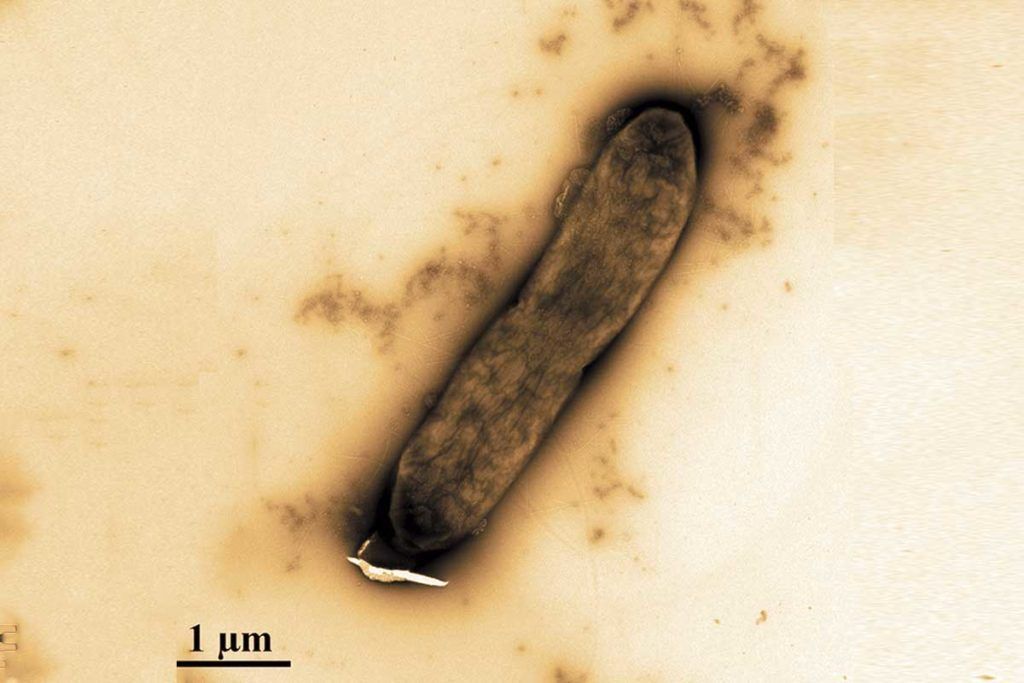 Nanopartículas de plata contra bacterias resistentes a antibióticos
