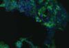 Así infecta el virus E de la hepatitis a las células Así infecta el virus E de la hepatitis a las células