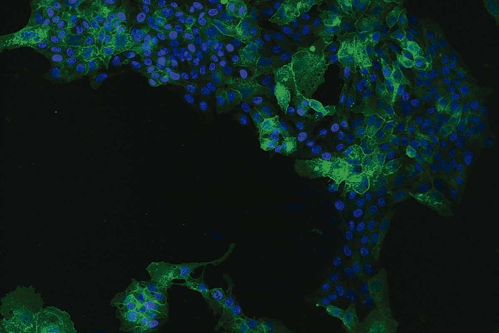 Así infecta el virus E de la hepatitis a las células