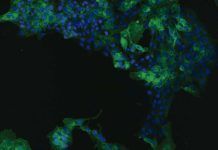 Así infecta el virus E de la hepatitis a las células Así infecta el virus E de la hepatitis a las células