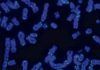 Telómeros, mitocondrias e inflamación, contra el cáncer Telómeros, mitocondrias e inflamación, contra el cáncer