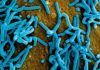 Éxito del primer resultado con la vacuna para el virus Marburg Éxito del primer resultado con la vacuna para el virus Marburg