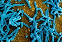 Éxito del primer resultado con la vacuna para el virus Marburg Éxito del primer resultado con la vacuna para el virus Marburg