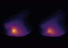 ¿Cómo el cerebro percibe el frío y el calor? ¿Cómo el cerebro percibe el frío y el calor?