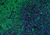 Innovador tratamiento experimental contra un cáncer pediátrico Innovador tratamiento experimental contra un cáncer pediátrico
