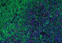 Innovador tratamiento experimental contra un cáncer pediátrico Innovador tratamiento experimental contra un cáncer pediátrico