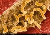 Una bacteria intestinal, vinculada a la aparición del Parkinson Una bacteria intestinal, vinculada a la aparición del Parkinson