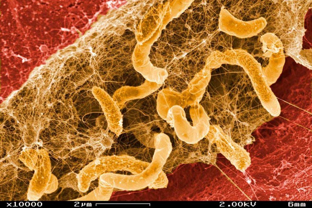 Una bacteria intestinal, vinculada a la aparición del Parkinson