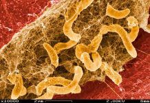 Una bacteria intestinal, vinculada a la aparición del Parkinson Una bacteria intestinal, vinculada a la aparición del Parkinson