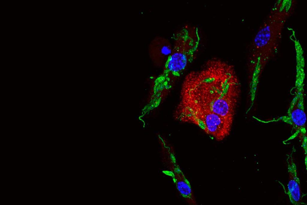 Cómo la Leishmania manipula las defensas inmunitarias