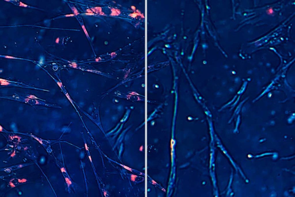 Identifican posibles fármacos antienvejecimiento con IA