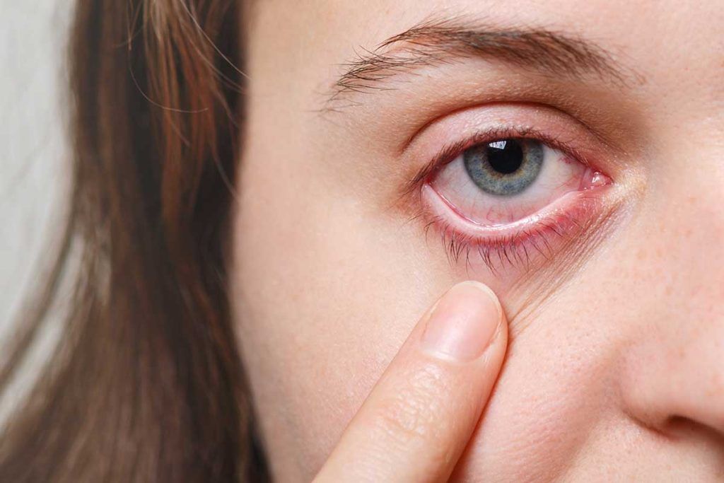 Herpes ocular: descubren una proteína clave en las reinfecciones