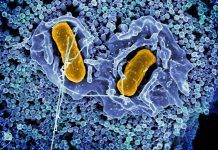 Innovador biosensor portátil que detecta ‘salmonella’ en alimentos Innovador biosensor portátil que detecta salmonella en alimentos