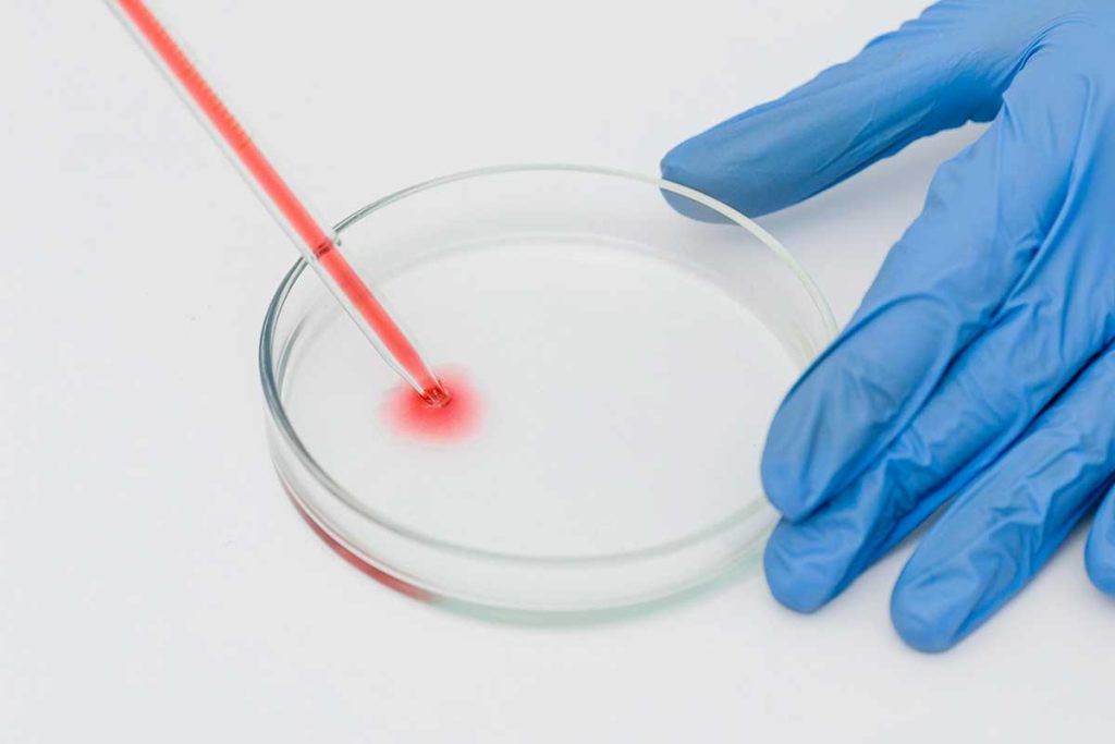 Una sola gota de sangre para detectar VIH y los virus B y C de la hepatitis
