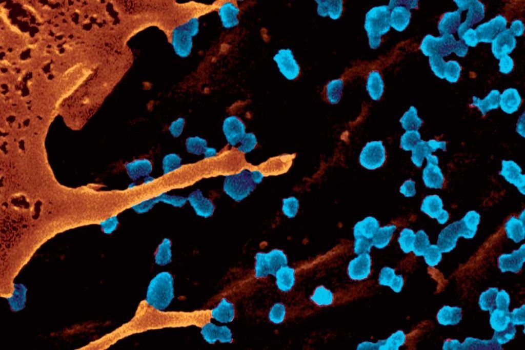 Avances en la vacuna contra el virus chikungunya