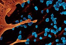 Avances en la vacuna contra el virus chikungunya Avances en la vacuna contra el virus chikungunya