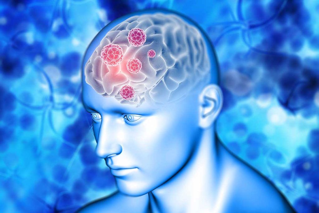 Visualizan el impacto de Covid-19 en el cerebro
