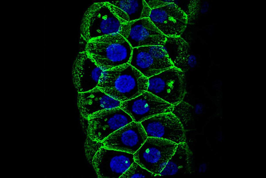‘Drosophila’, clave para desvelar mecanismos de infección en Covid-19
