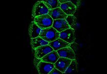 ‘Drosophila’, clave para desvelar mecanismos de infección en Covid-19 ‘Drosophila’, clave para desvelar mecanismos de infección en Covid-19