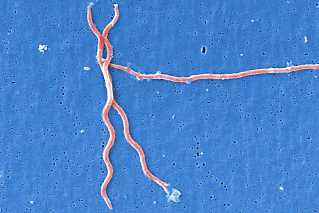 Nueva luz en el tratamiento de la enfermedad de Lyme