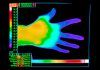 Dos genes causan el síndrome de Raynaud Dos genes causan el síndrome de Raynaud