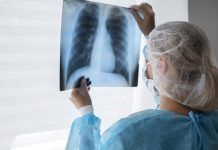 Tuberculosis: nueva estrategia para potenciar el sistema inmune Nueva estrategia para potenciar el sistema inmune frente a la tuberculosis
