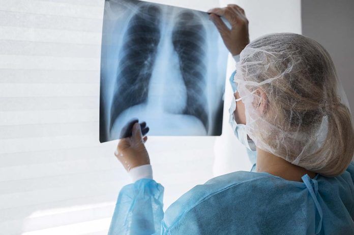 medico radiografia Nueva estrategia para potenciar el sistema inmune frente a la tuberculosis