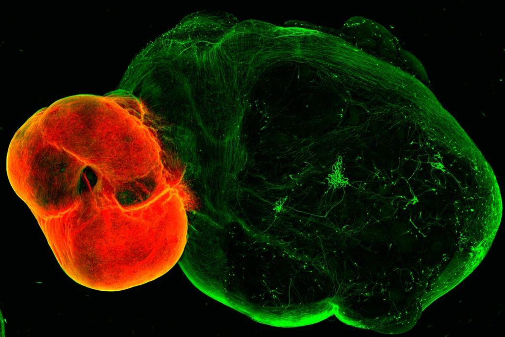 Nueva luz sobre el sistema dopaminérgico del cerebro