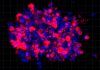Organoides, en lugar de ratones, contra el cáncer de páncreas Organoides, en lugar de ratones, contra el cáncer de páncreas