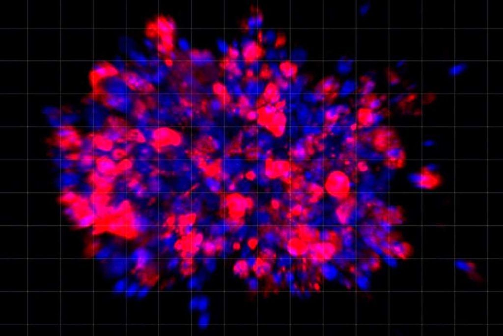 Organoides, en lugar de ratones, contra el cáncer de páncreas