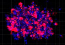 Organoides, en lugar de ratones, contra el cáncer de páncreas Organoides, en lugar de ratones, contra el cáncer de páncreas