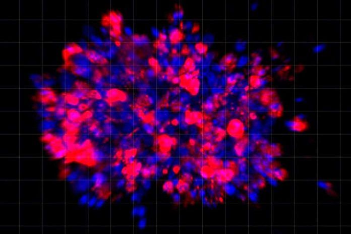 organoides Organoides, en lugar de ratones, contra el cáncer de páncreas