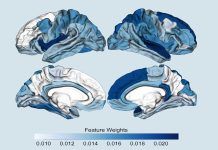 Psicosis: nueva herramienta para predecir su aparición Psicosis: nueva herramienta para predecir su aparición