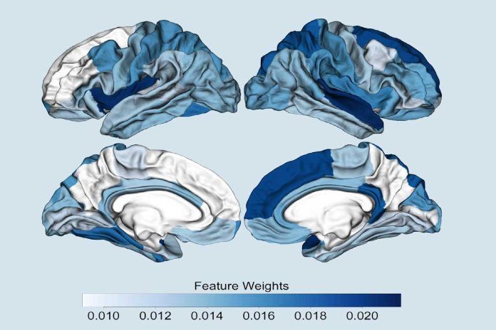 Psicosis: nueva herramienta para predecir su aparición