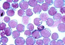 Desvelan la maquinaria génica que transforma las células B en malignas Desvelan la maquinaria génica que transforma las células B en malignas