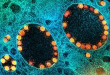SARS-CoV-2 puede resistir en el cuerpo más de un año SARS-CoV-2 puede resistir en el cuerpo más de un año