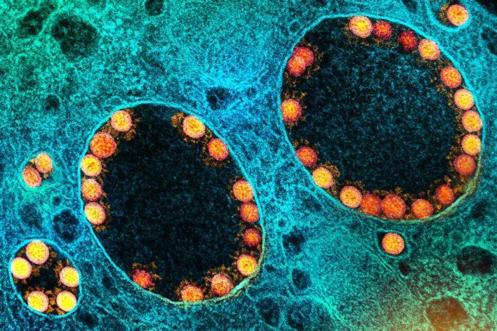 SARS-CoV-2 puede resistir en el cuerpo más de un año
