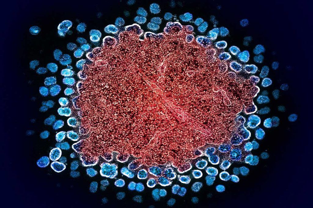Hacia el control del virus que causa el sida