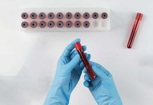 Innovador análisis para la detección precoz del cáncer Innovador análisis para la detección precoz del cáncer
