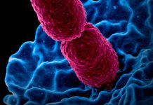 Primer catálogo de bacterias presentes en la metástasis del cáncer Primer catálogo de bacterias presentes en la metástasis del cáncer