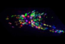 Con ‘C. elegans’, arrojan luz sobre zonas oscuras del cerebro humano Con C. elegans, arrojan luz sobre zonas oscuras del cerebro humano