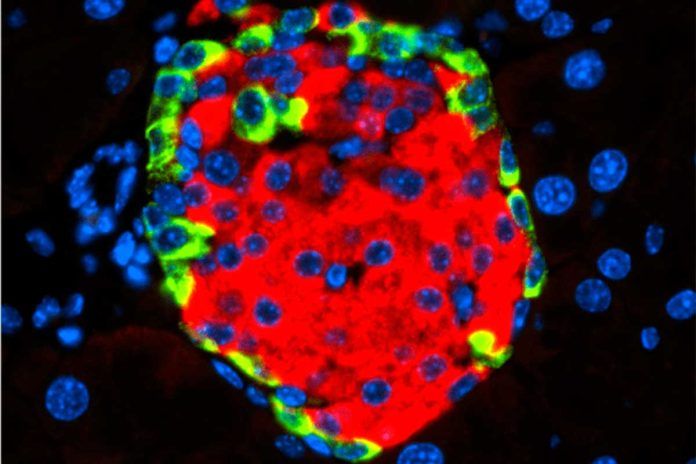 islotes ¿Es un virus la causa de la diabetes 1?