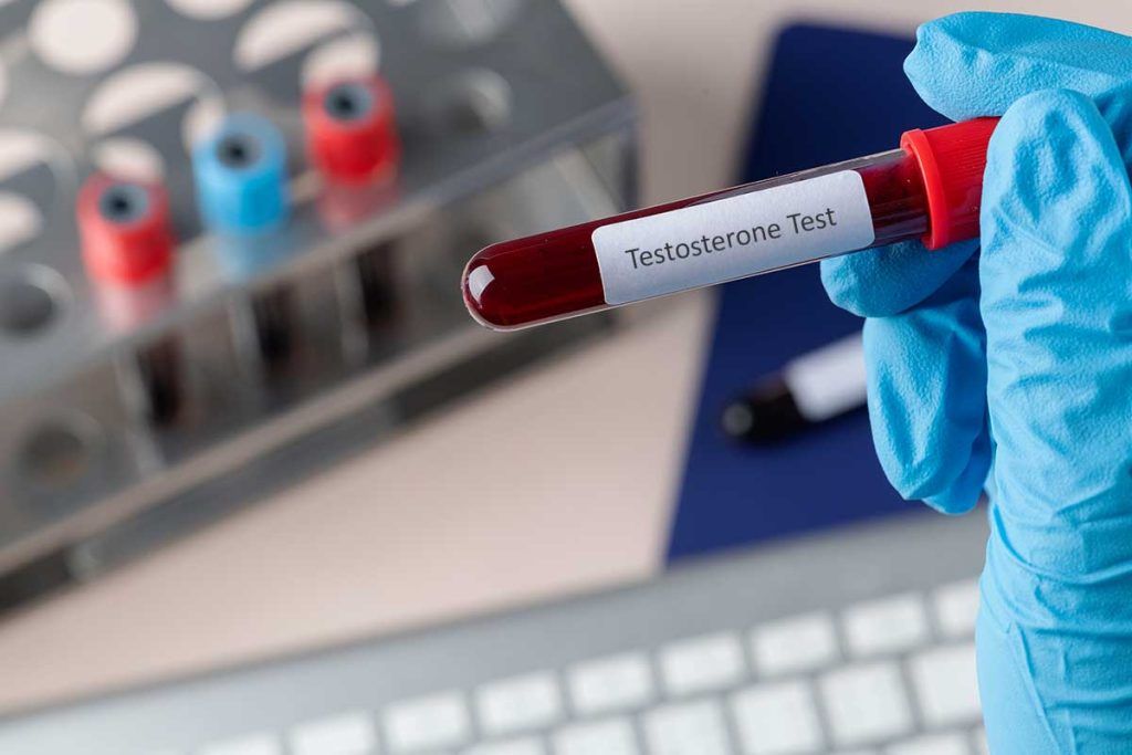 Asocian niveles bajos de testosterona con mayor riesgo de muerte