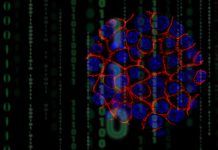 Crean un modelo matemático para el cáncer de páncreas