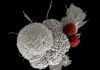 Identifican un objetivo potencial en la inmunoterapia anti cáncer Identifican un objetivo potencial en la inmunoterapia anti cáncer