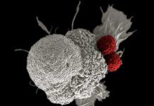 Identifican un objetivo potencial en la inmunoterapia anti cáncer Identifican un objetivo potencial en la inmunoterapia anti cáncer