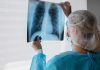 Diagnóstico molecular para no fumadores con cáncer de pulmón Diagnóstico molecular para no fumadores con cáncer de pulmón