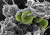Resistencia antimicrobiana: innovadora vacuna frente a ‘Staphylococcus aureus’ Resistencia antimicrobiana: innovadora vacuna frente a 'Staphylococcus aureus'